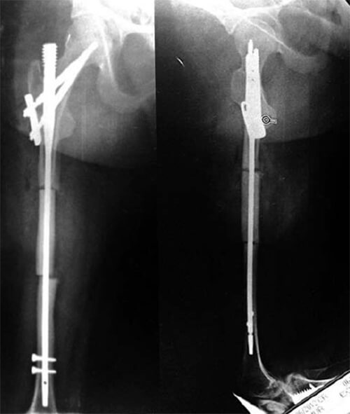 Figura B: Post-Operatorio