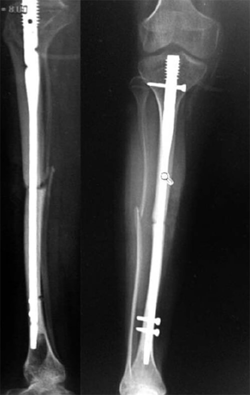 Figura B: Post-Operatorio