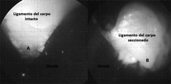 Figura Nº 4