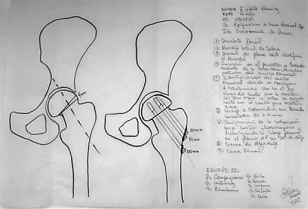 Figura N° 3. Planificación preoperatoria