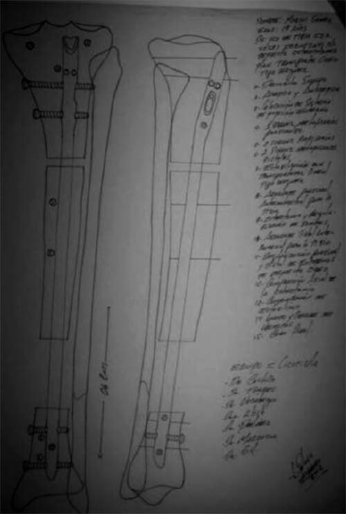 Figura 3. Planificación pre operatoria