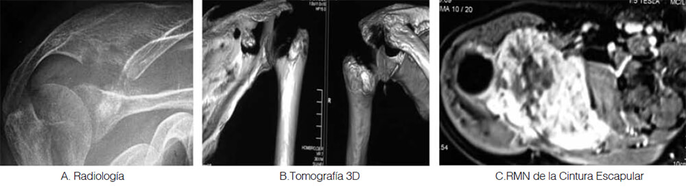 Figura N° 1