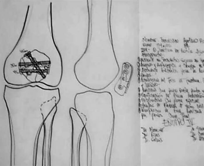 Figura N° 2. Planificación preoperatoria