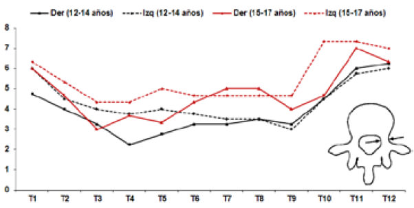 Grafico 1. Análisis morfométrico del ancho transversal pedicular.