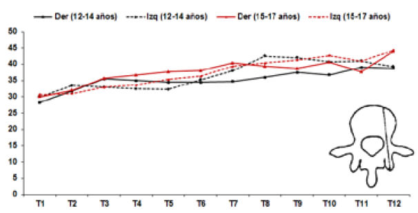 Grafico 4. Análisis morfométrico de la profundidad de inclusión en cuerpo vertebral.