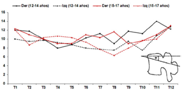 Grafico 6. Análisis morfométrico del ángulo sagital pedicular.