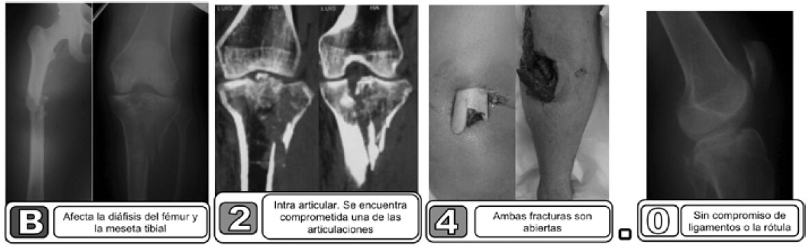 Figura 2. Ejemplo 1.