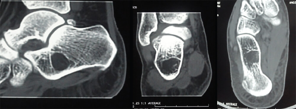Figura 3. Imágenes de la Tomografía axial computarizada.