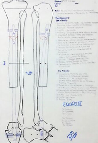 Figura 4. Planificación pre operatoria.