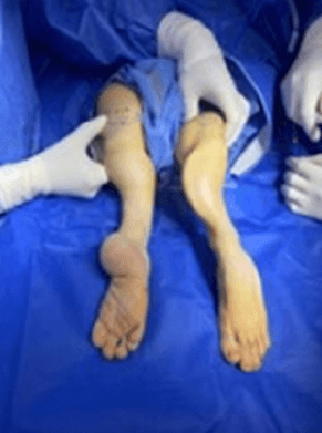 Figura 1. Imagen preoperatoria.