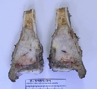 Figura 5. Aspecto macroscópico de la pieza en corte coronal.