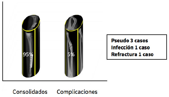 Resultados del Tratamiento de las Fracturas Diafisarias de Antebrazo en Niños con Enclavado Flexible I.A.H.U.L.A (2006-2010) GRAFICO 4