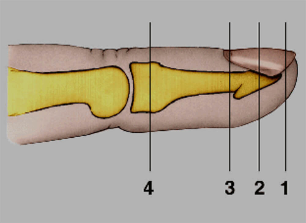 Figura 2
