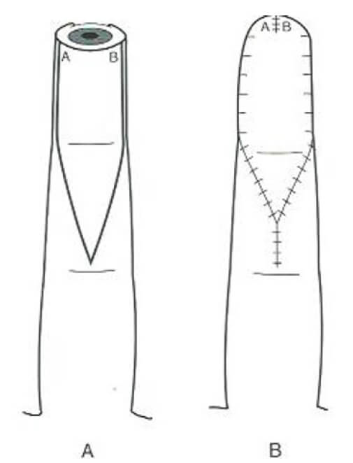 Figura 4
