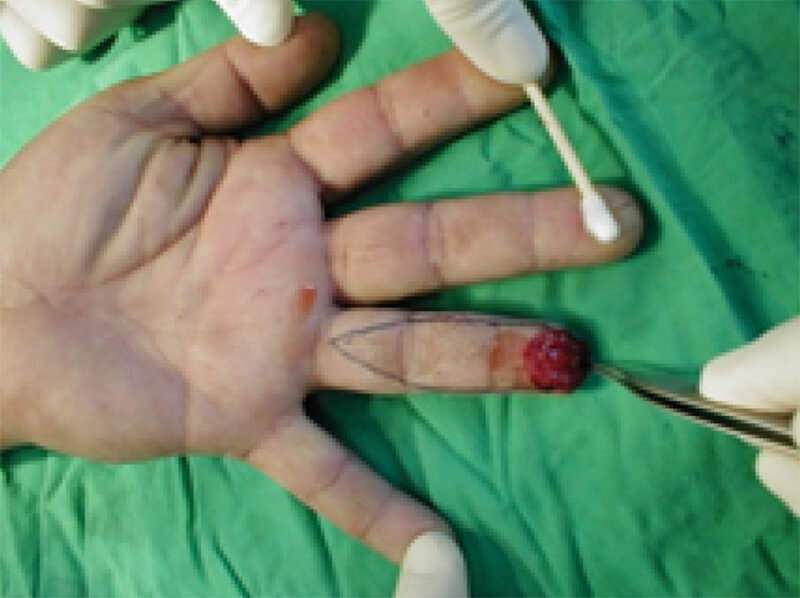 Figura 6